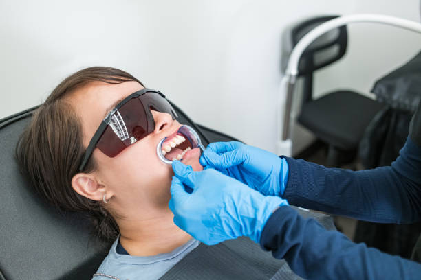 Best Knocked-Out Tooth (Avulsed Tooth) Treatment in Riverdale, UT